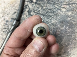 Montrer prothèse oculaire